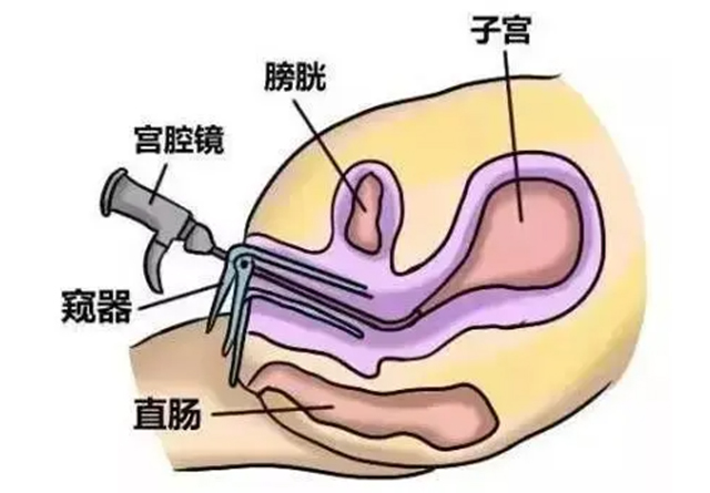 专业医师+专业设备，忻竹宫腔镜诊疗服务正式开启！